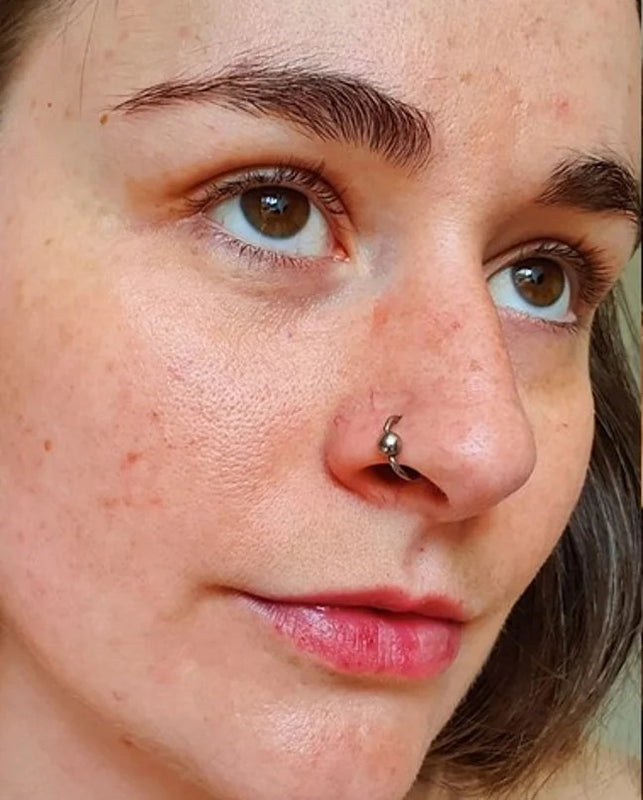 Before - Sarah M.